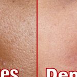 As 10 Dicas Para Emagrecer Rápido em Casa